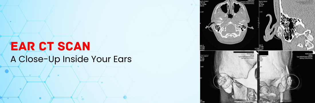 Ear CT Scan: A Close-Up Inside Your Ears